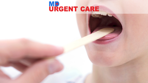 Read more about the article The Complete Guide to Strep Throat